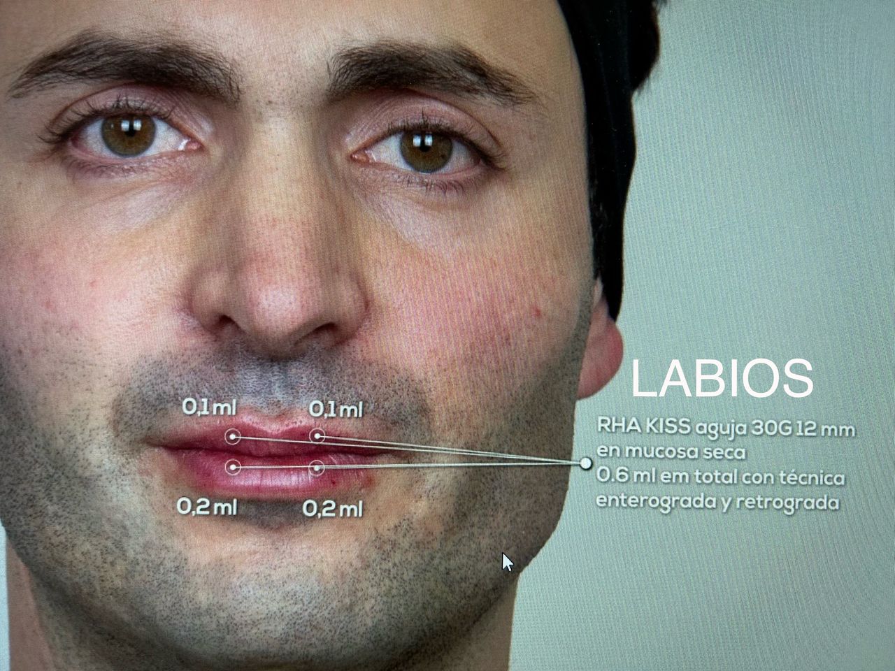 Arsenio Menchero Sánchez-40