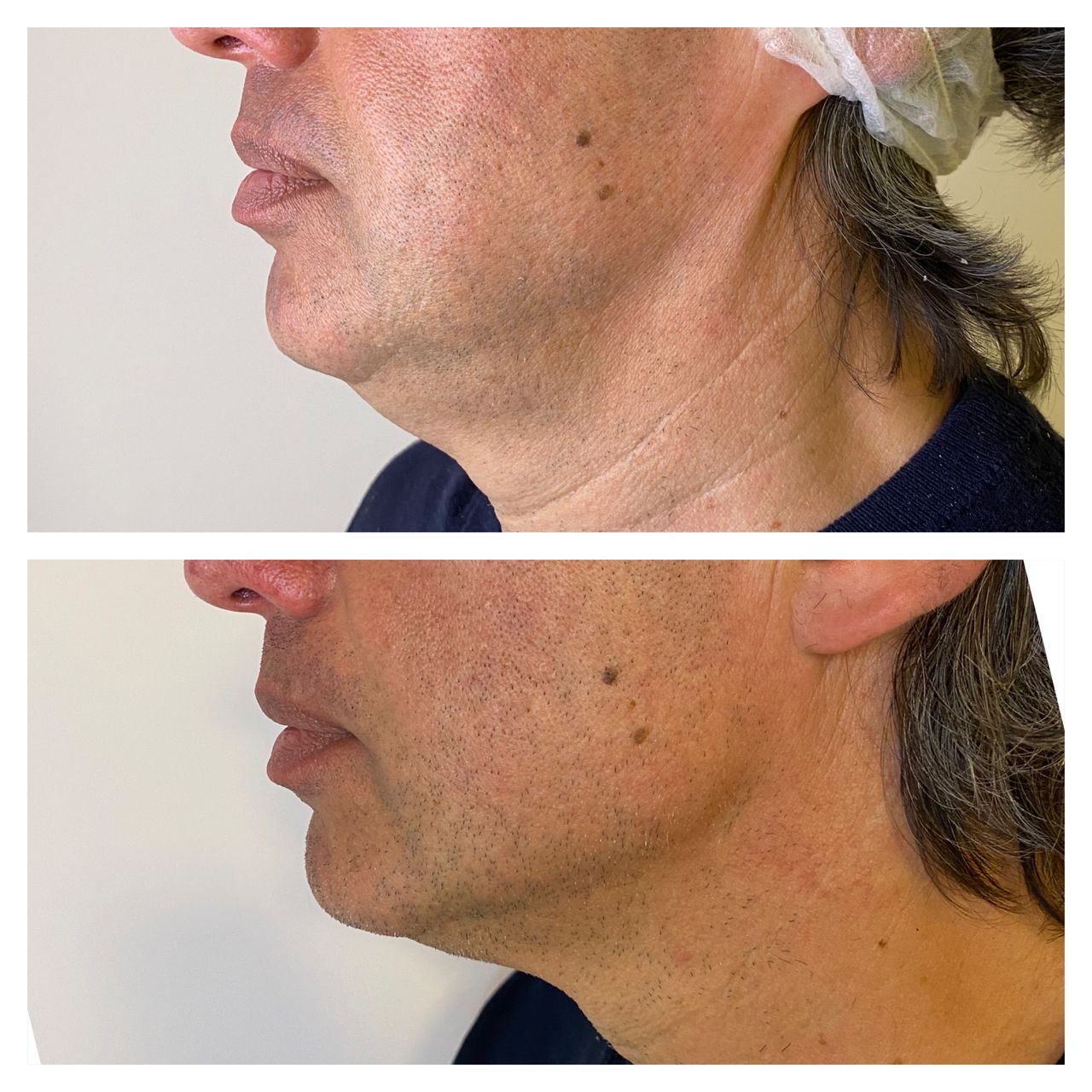 Elisabetta Fabiani-100