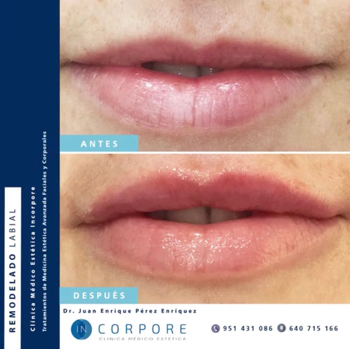 Juan Enrique Pérez Enríquez-120