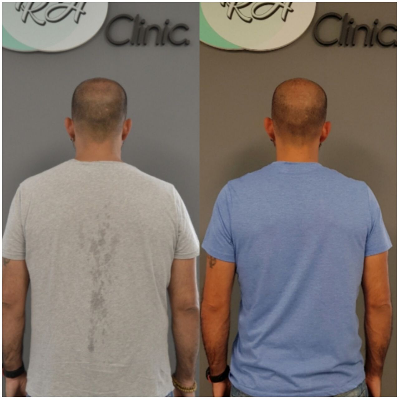 Rosalba Herrero Zerpa-84