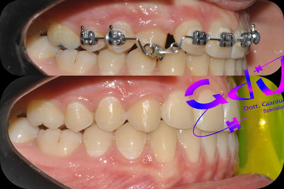 Gianluca Del Vecchio-147