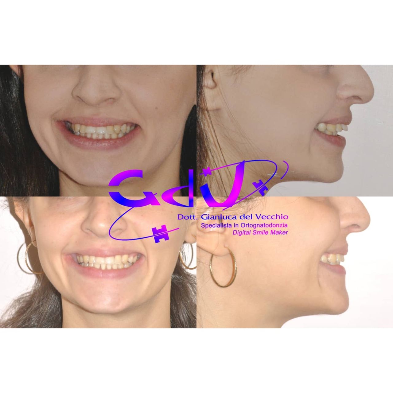 Gianluca Del Vecchio-152