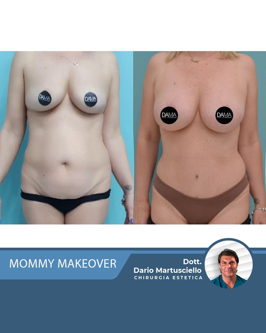 Dario Martusciello-29