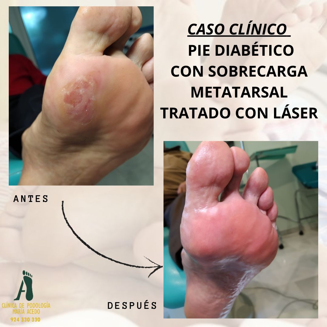 Maria Acedo Cañamero-3