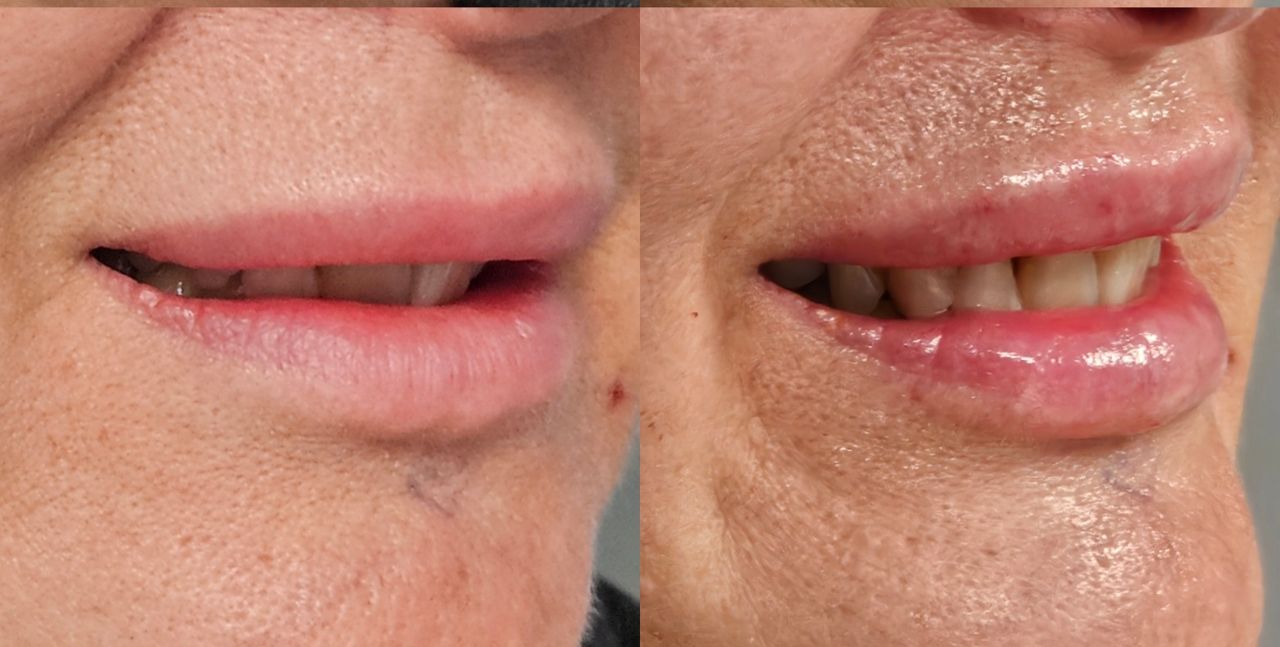 Rosalba Herrero Zerpa-579