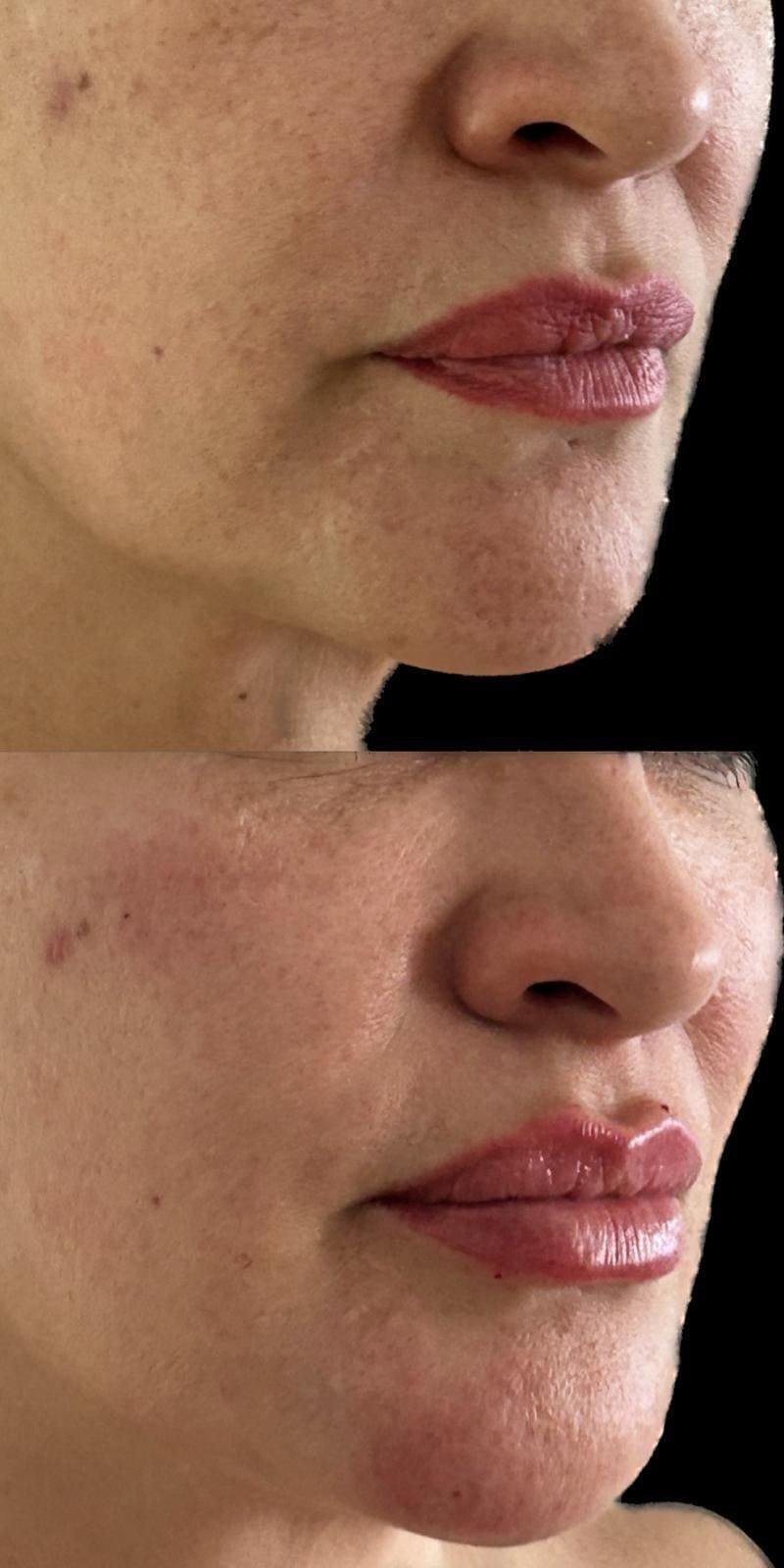 Tulio Andrés Álvarez Cáceres-2