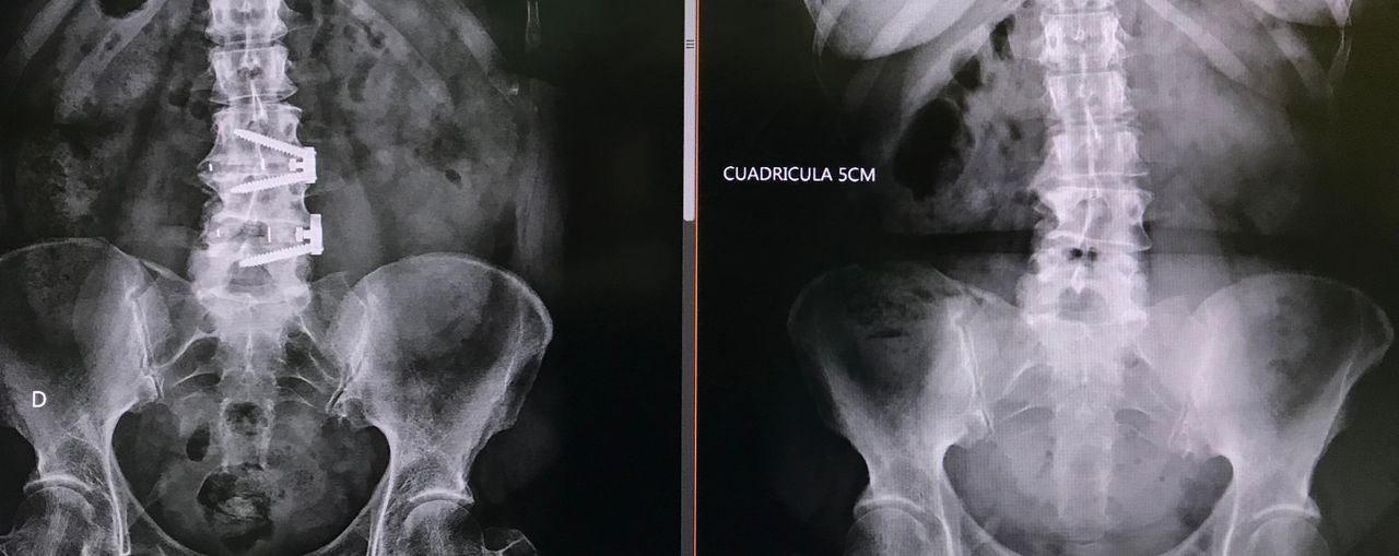 Juan Camilo Hernandez Acevedo-20