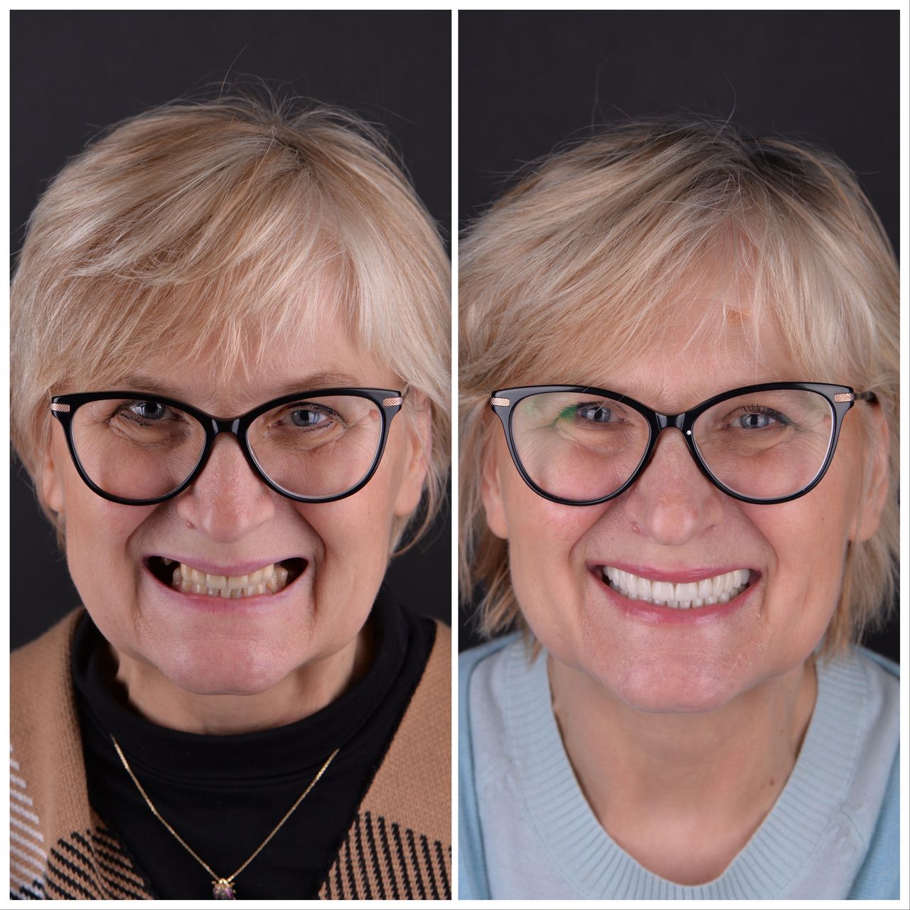 Martin Bartoszcze-18