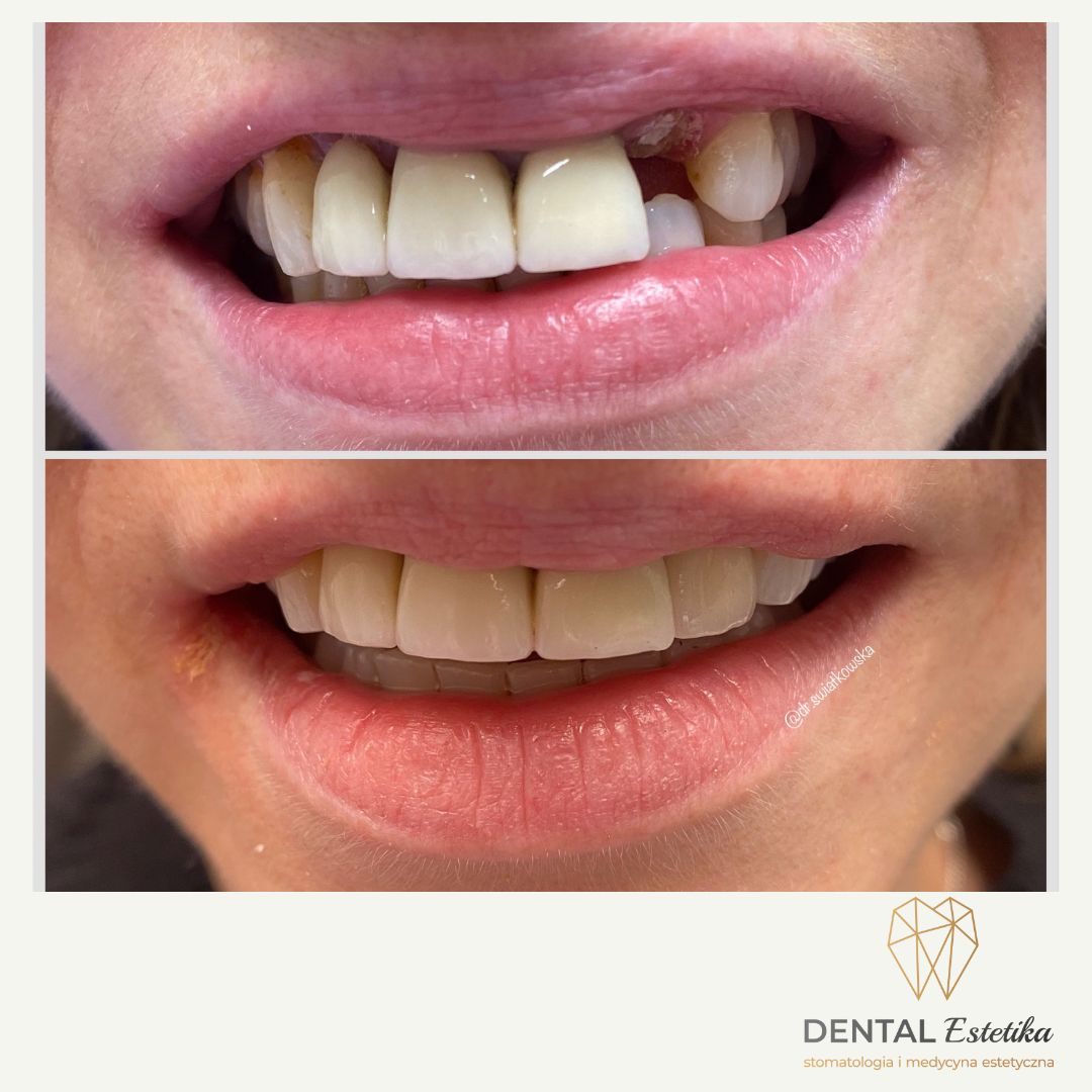 Angelika Świątkowska-20