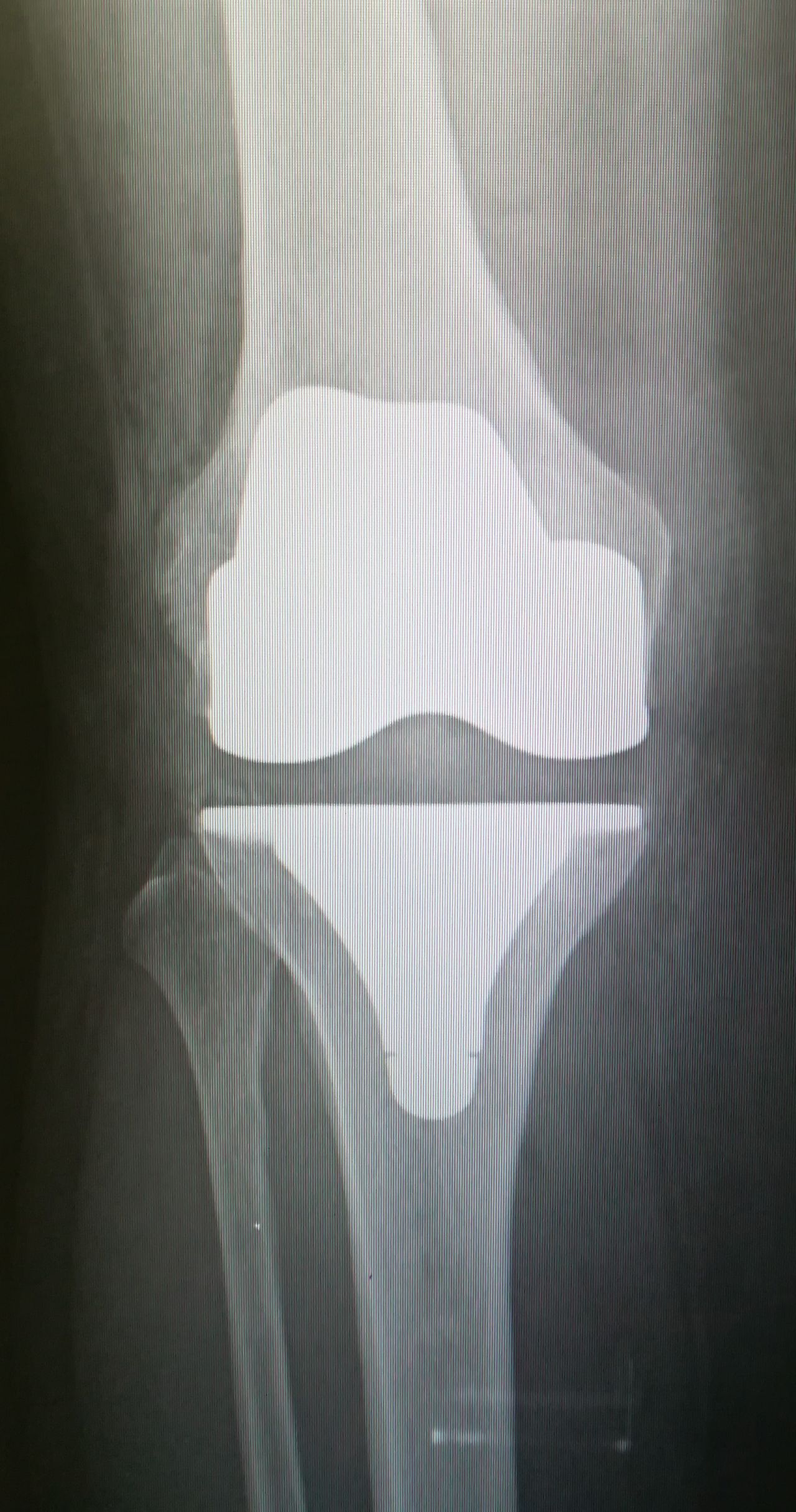 Gennaro Campopiano-1