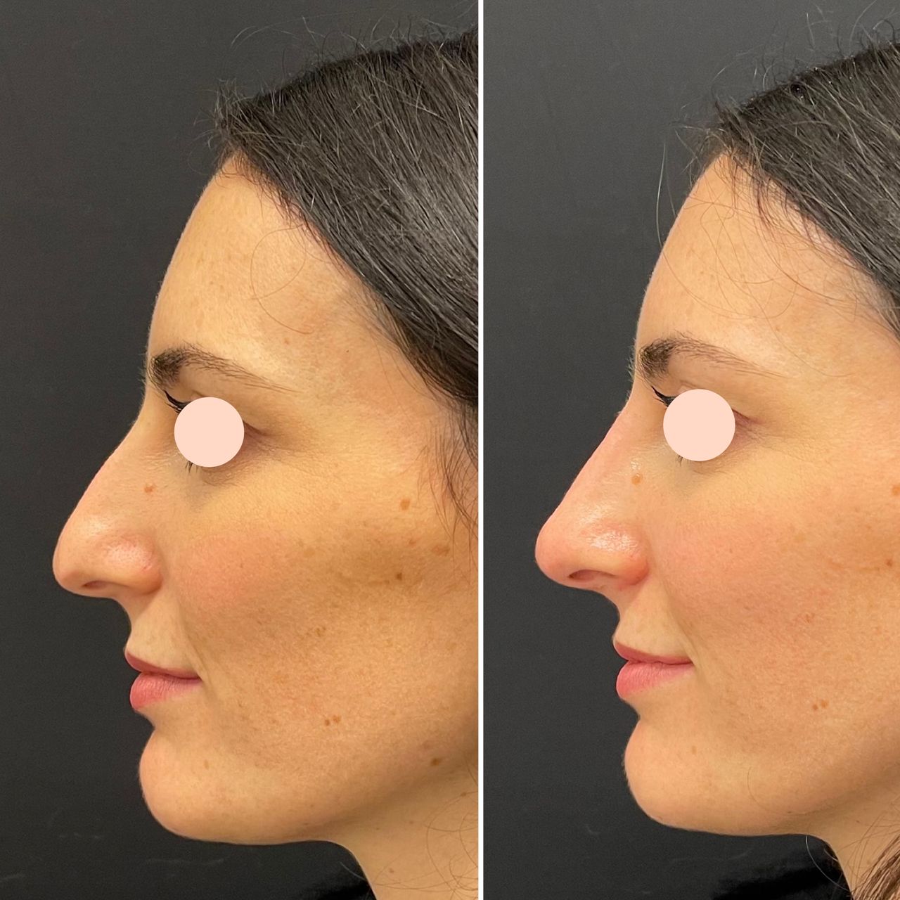 Leonardo Scortecci-3