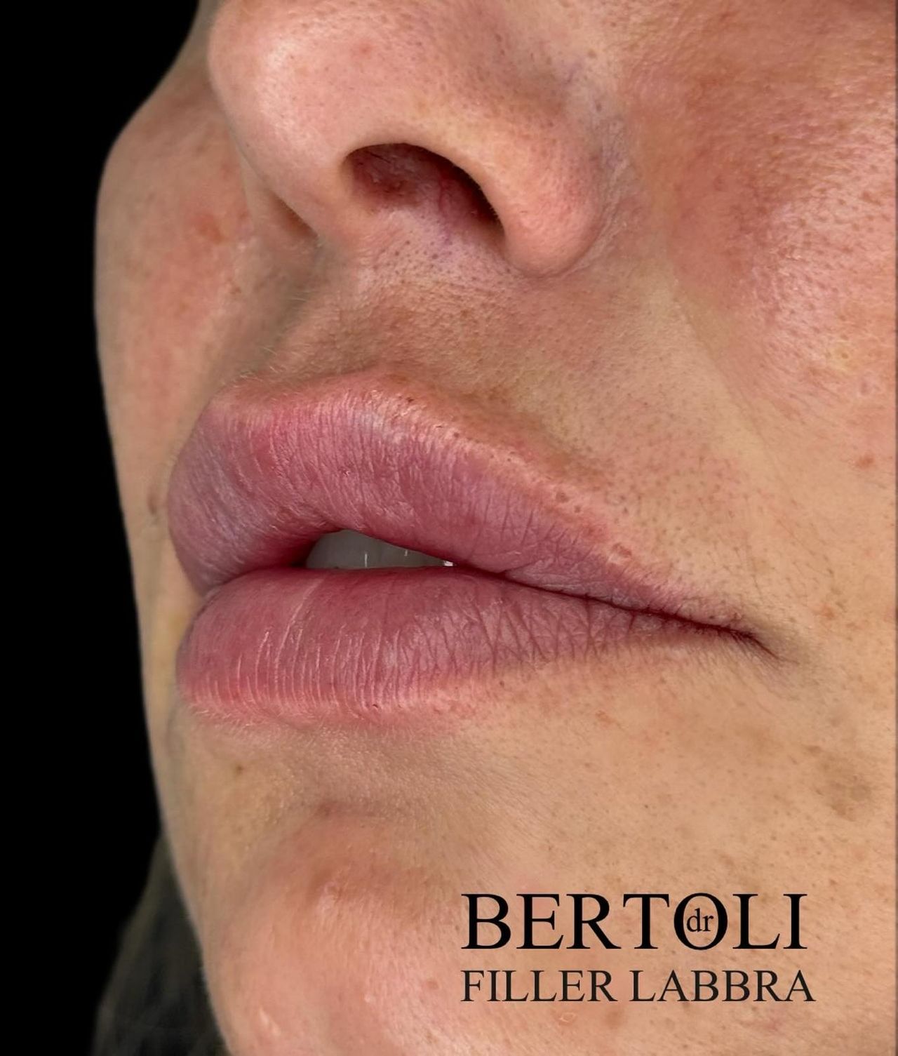 Andrea Bertoli-6