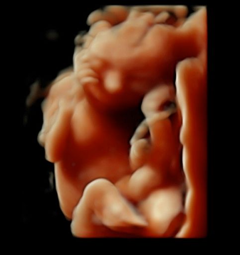 Tommaso Incandela-24