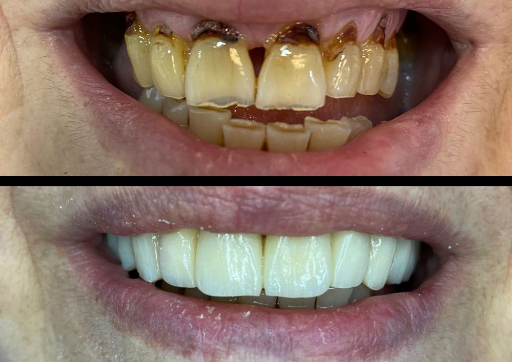 Alessandro Cassese-16