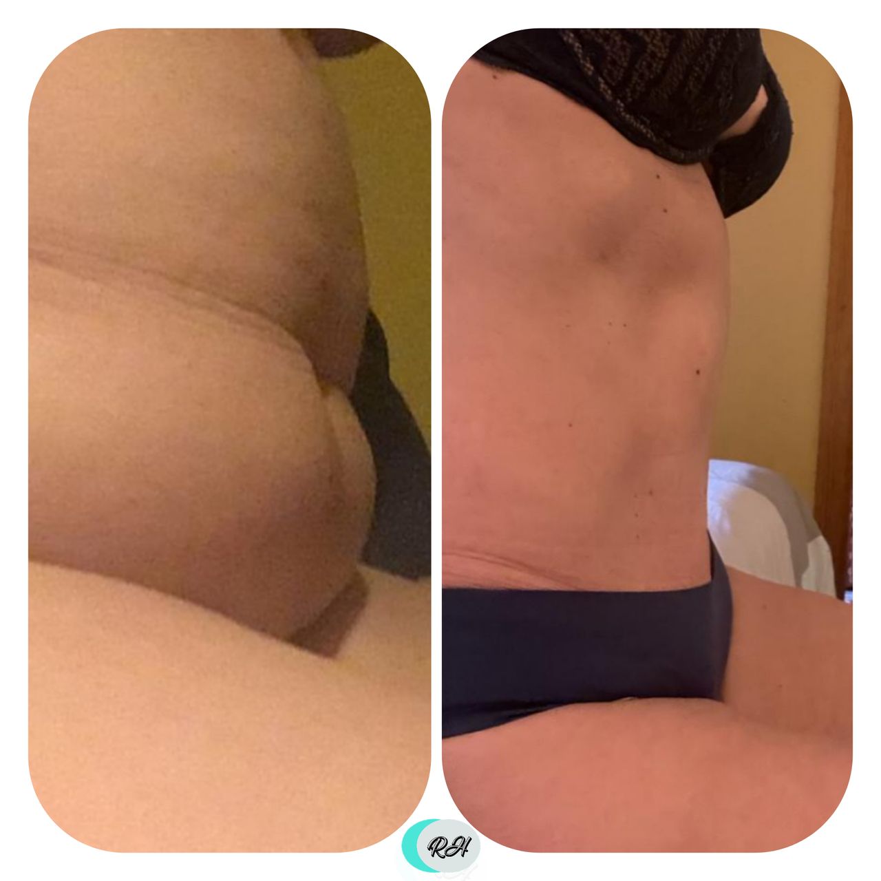 Rosalba Herrero Zerpa-180