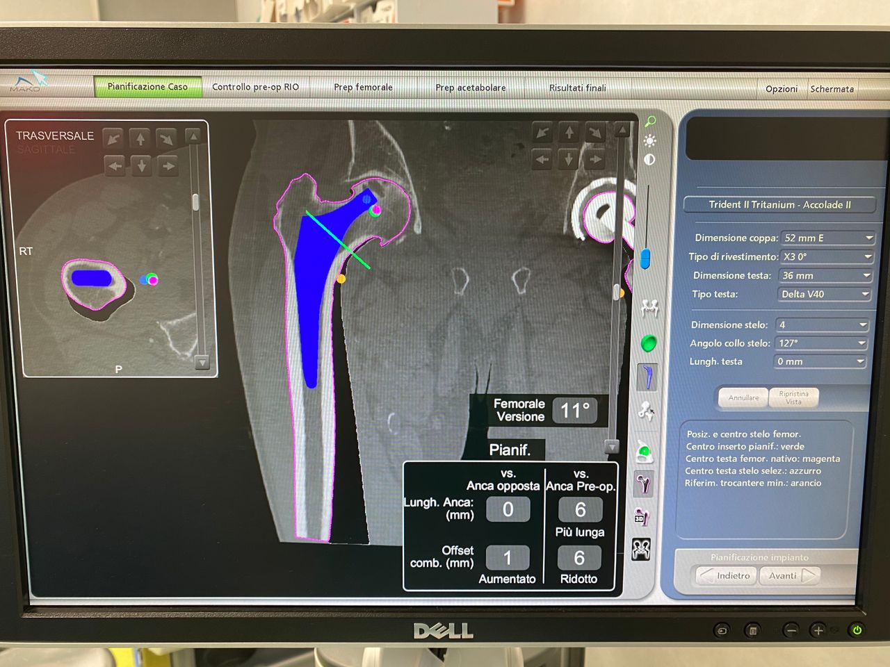 Antonio Francesco Masia-4