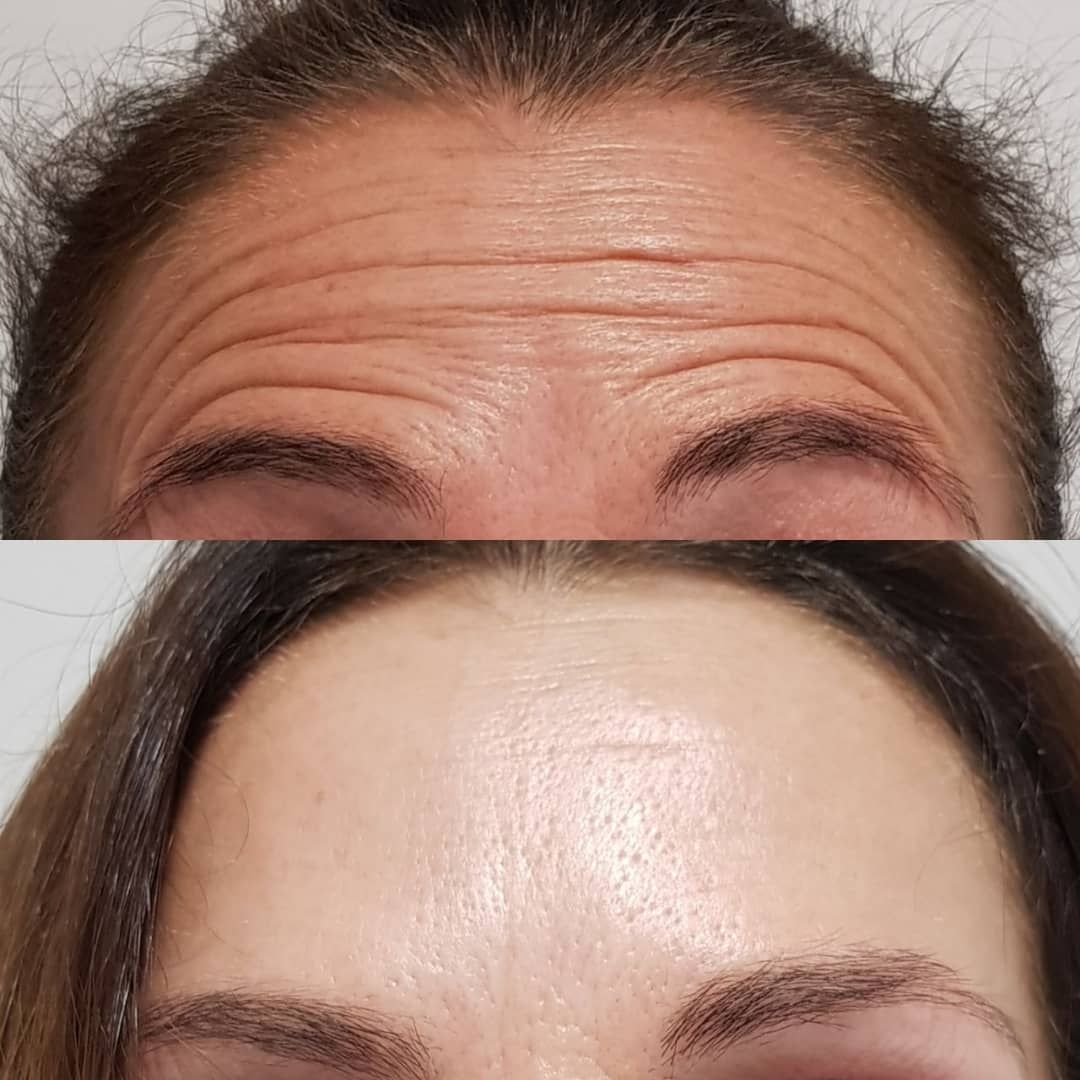 Rosalba Herrero Zerpa-474