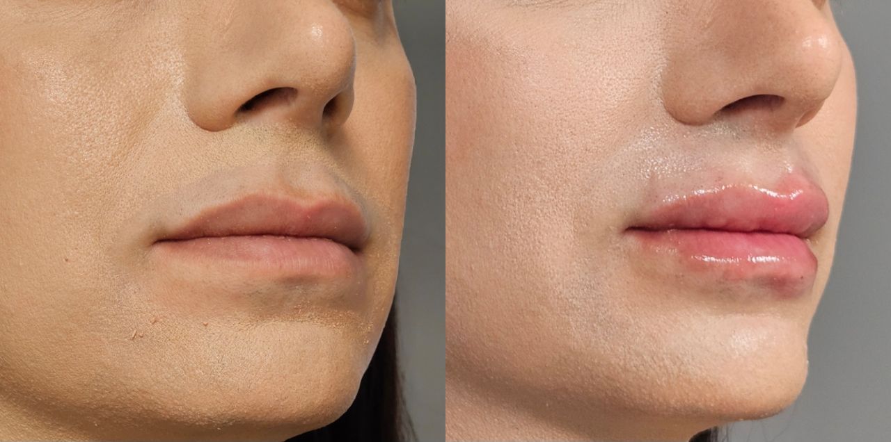 Rosalba Herrero Zerpa-45