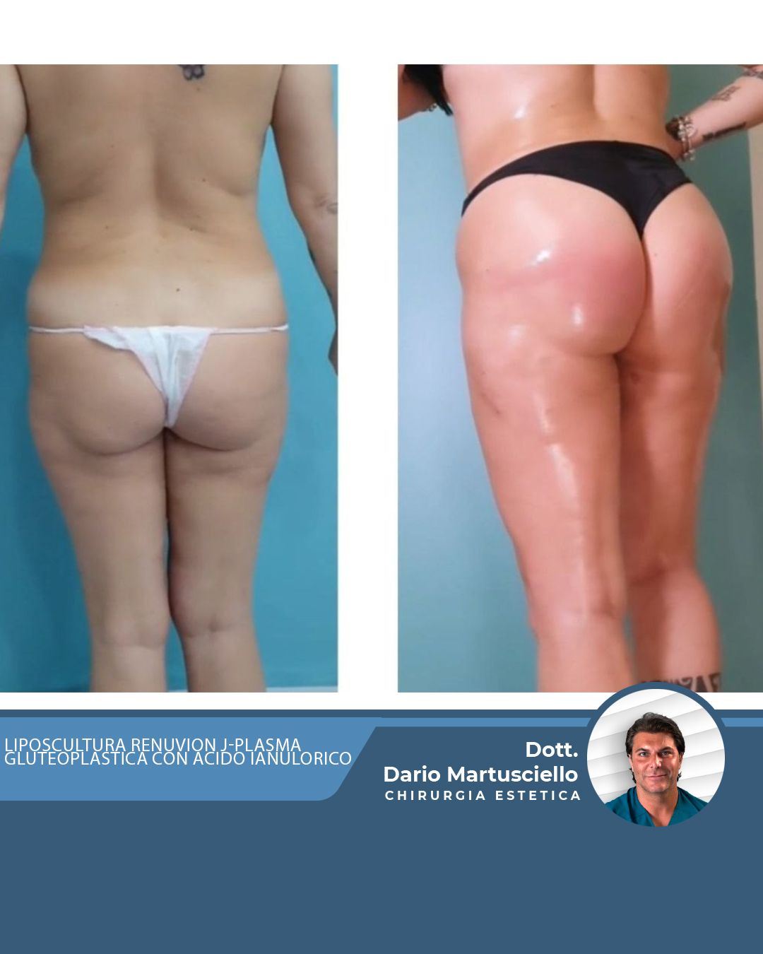 Dario Martusciello-28