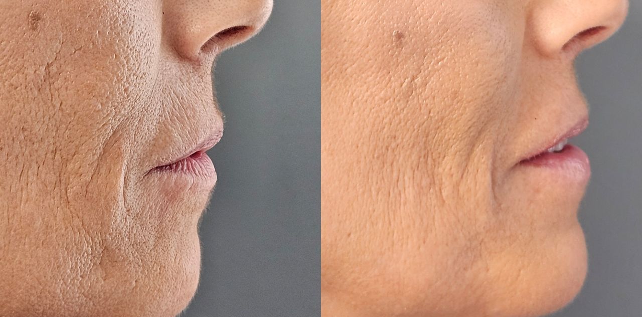 Rosalba Herrero Zerpa-453