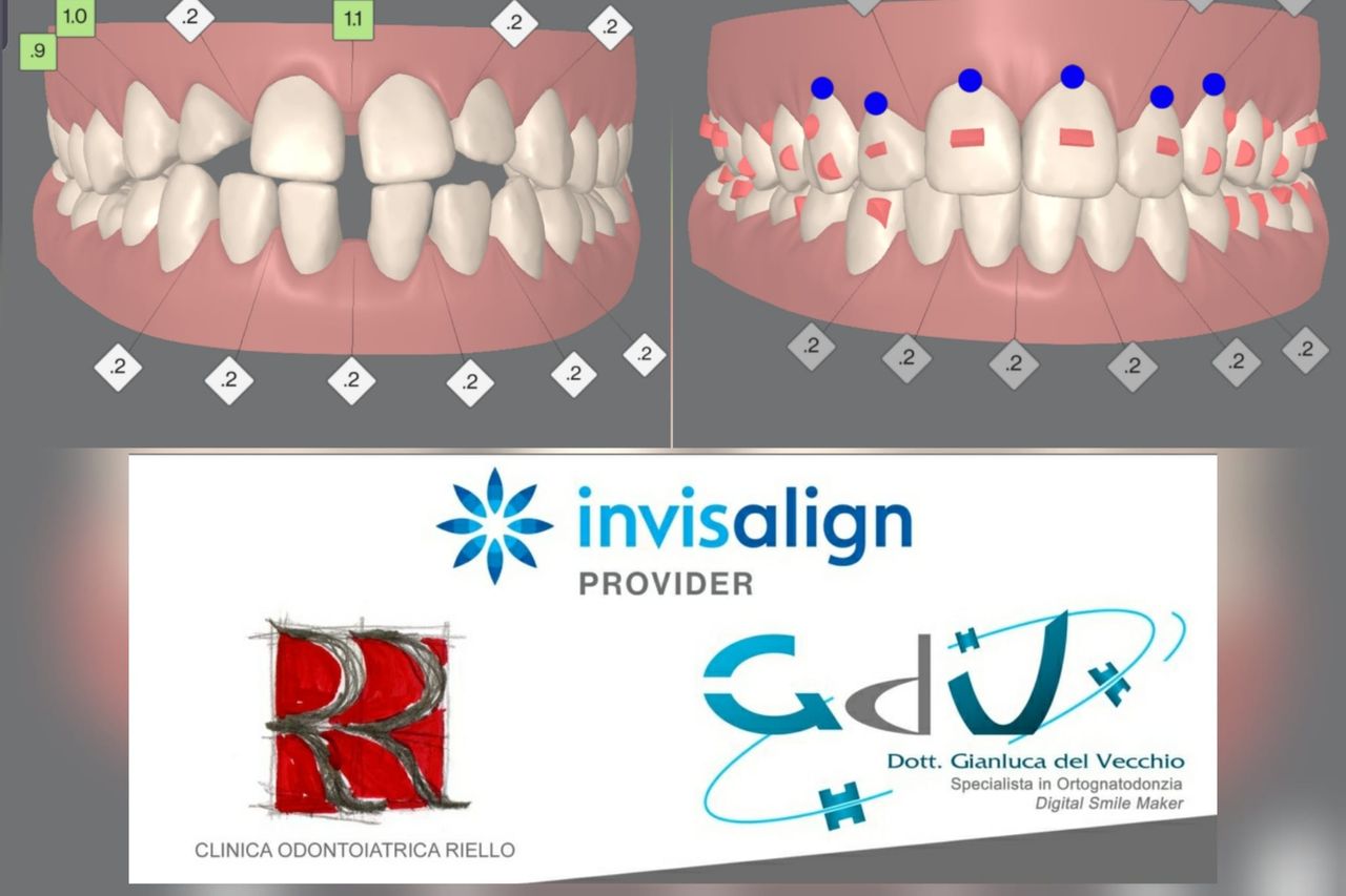 Gianluca Del Vecchio-180