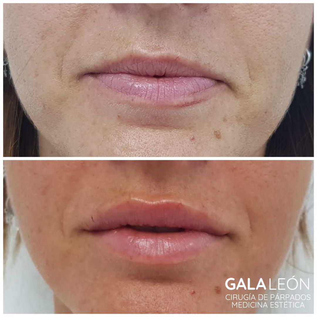 Gala P. Leon Salvatierra-3