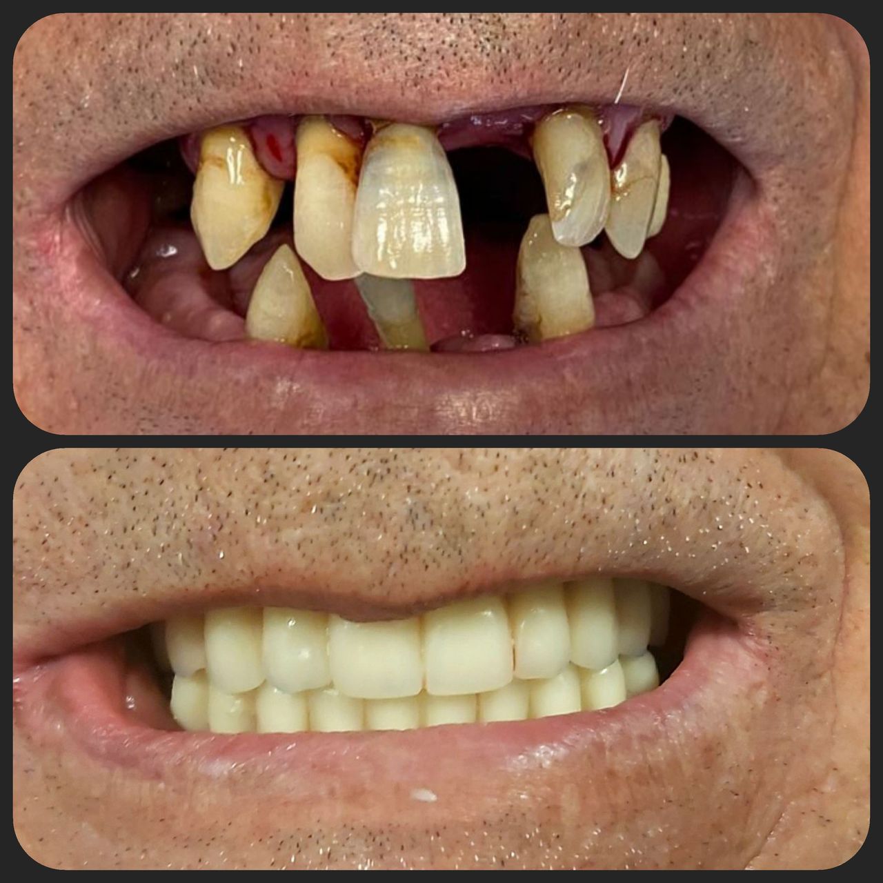 Lorenzo Paolo Bottini-0