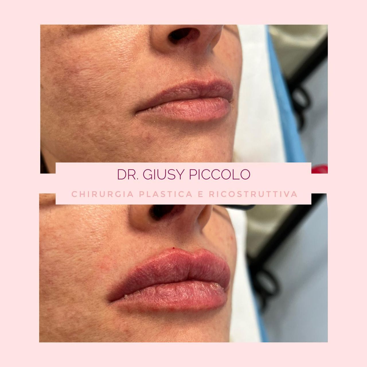 Giuseppina Piccolo-27