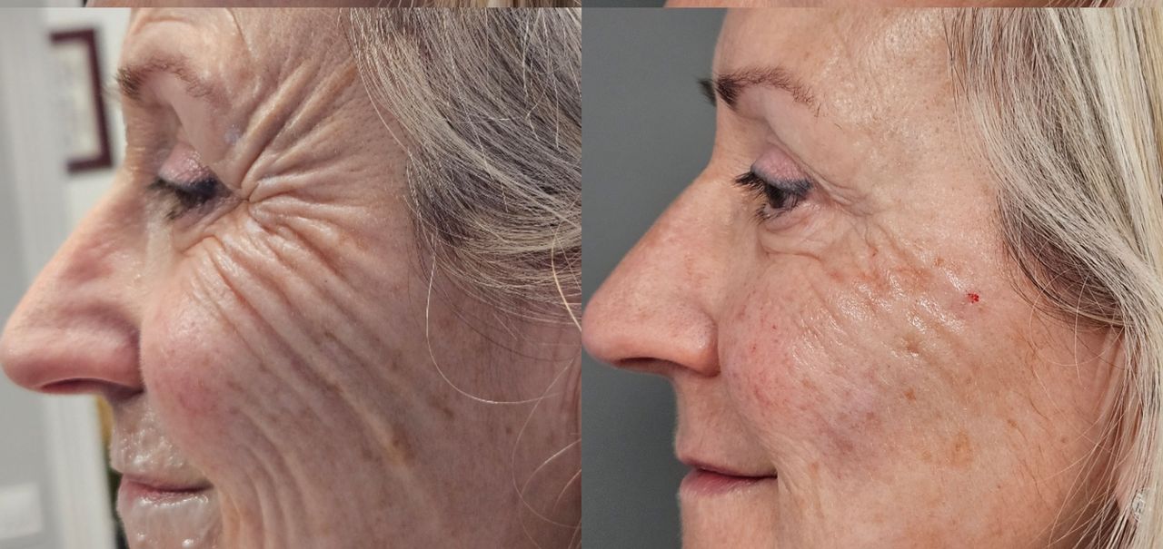 Rosalba Herrero Zerpa-11