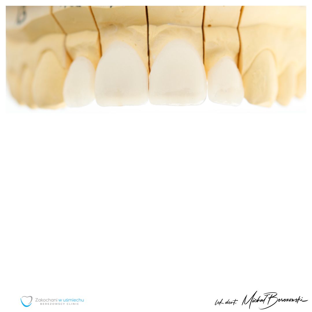 Michał Berezowski-19