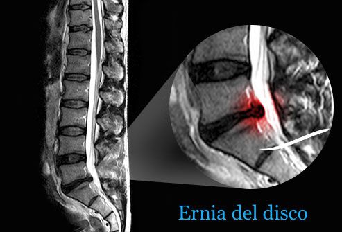 Carmine Del Gaìzo-9