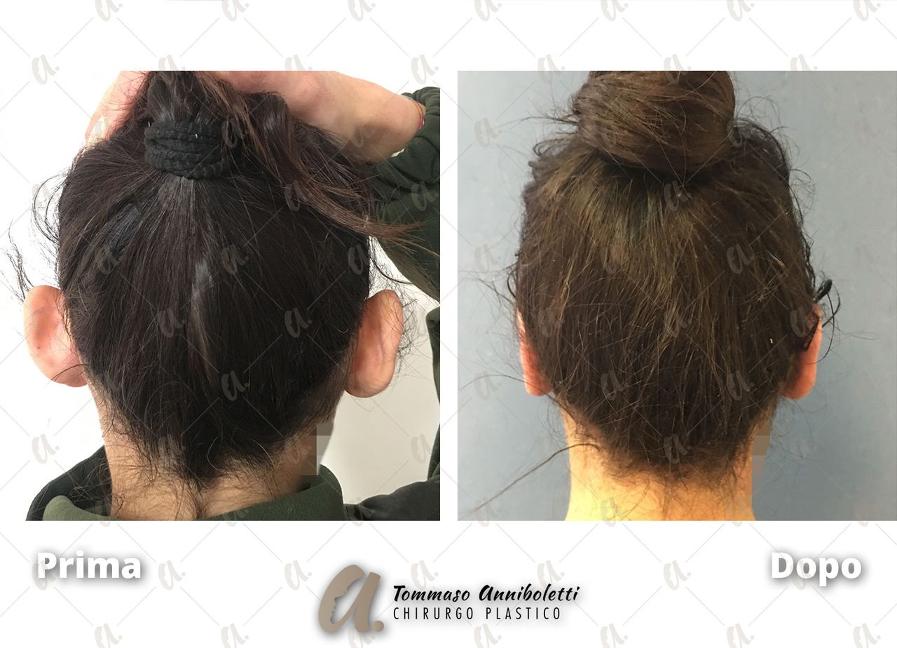 Tommaso Anniboletti-51