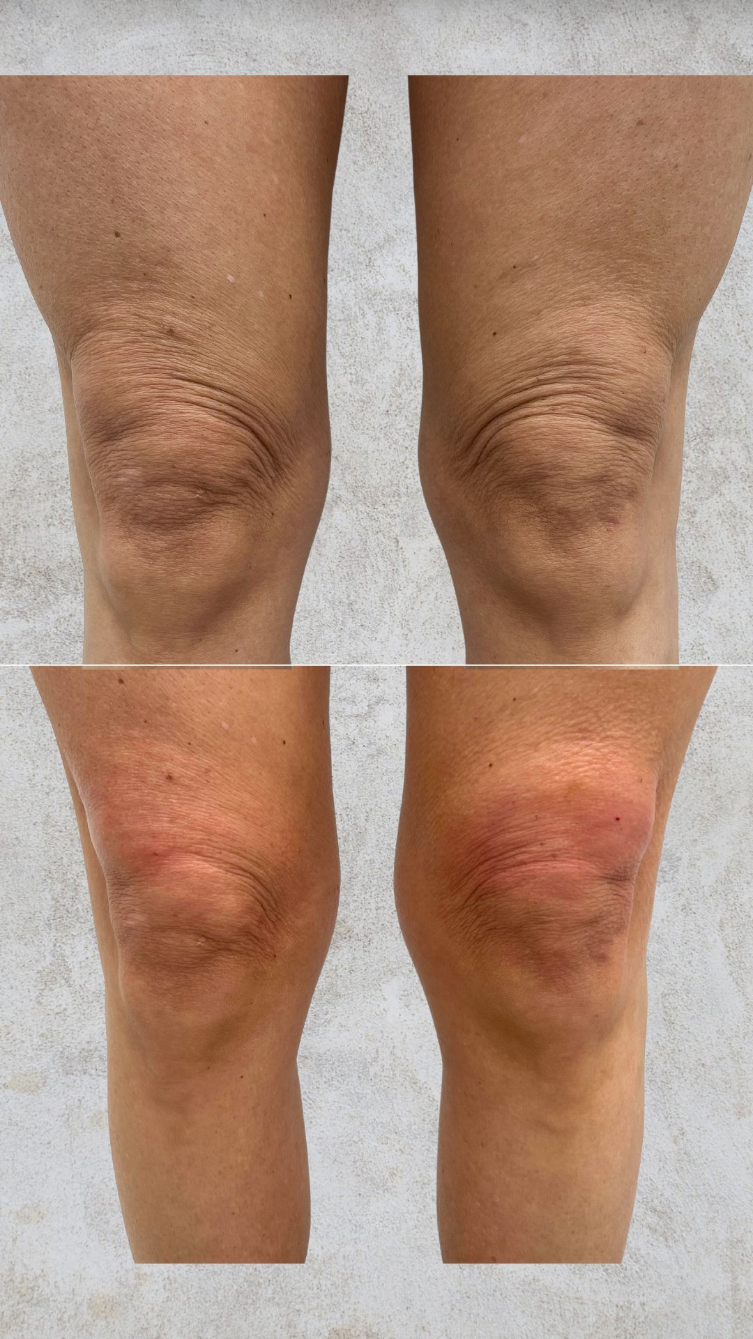 Yusimy Venereo Ramirez-5