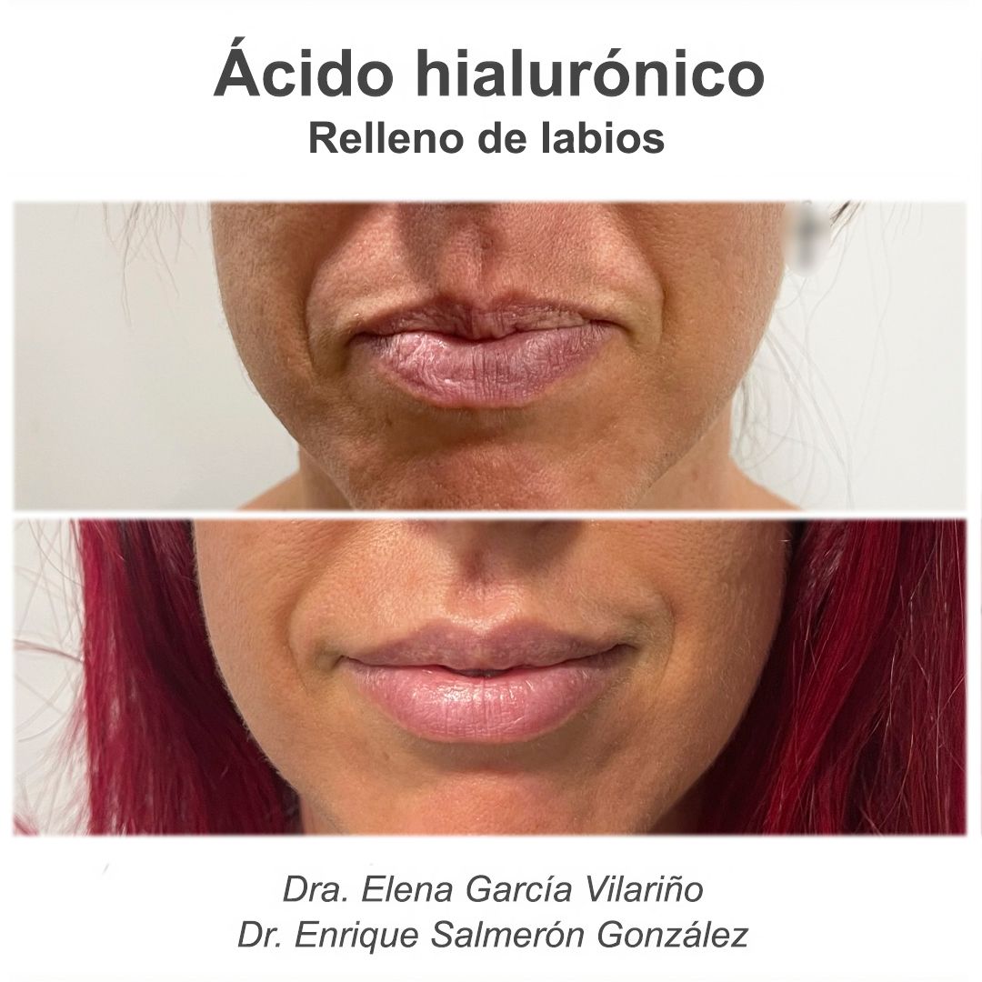 Enrique Salmerón González-74