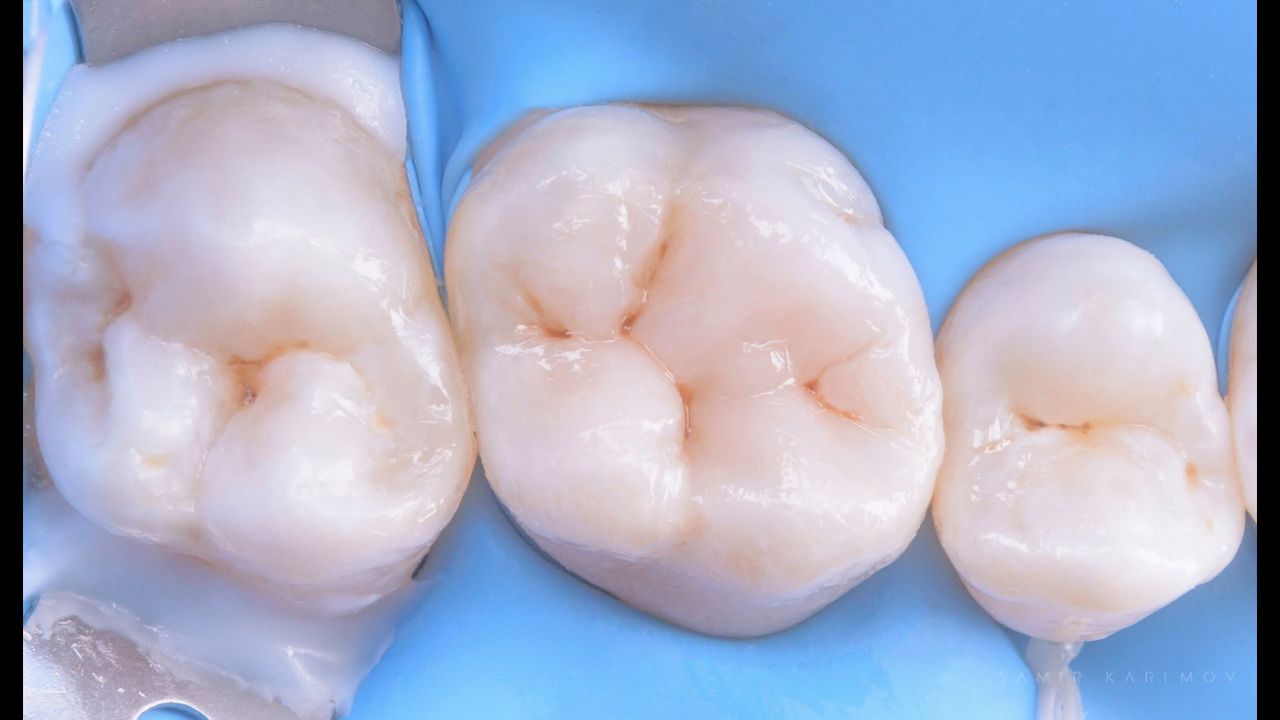 Volodymyr Kachmar-18