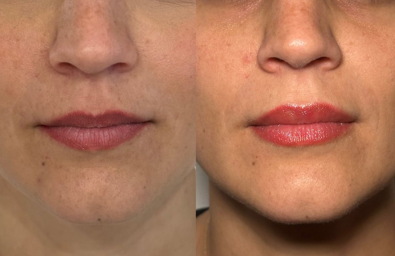 Alessandro Carraro-5