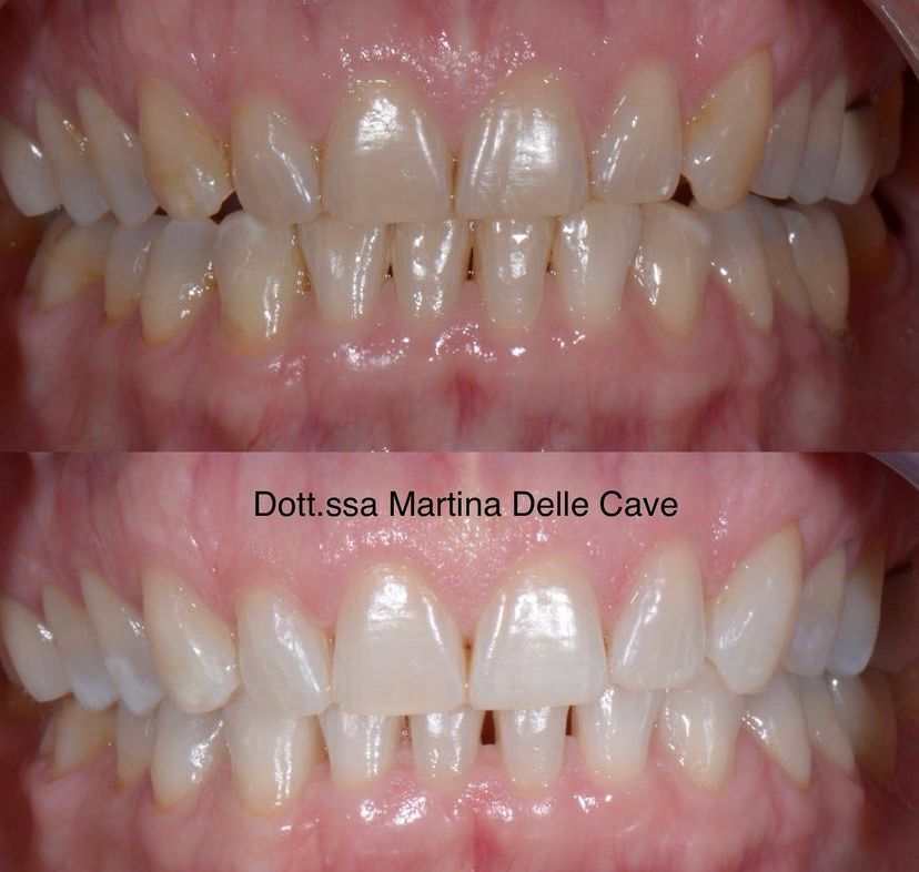 Martina Delle Cave-9