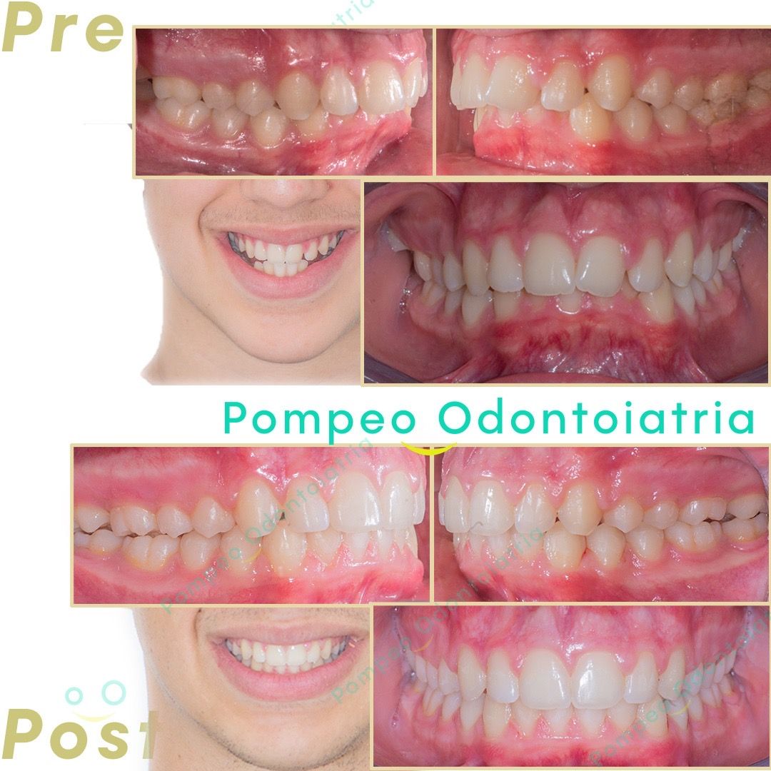 Enrico Maria Pompeo-1