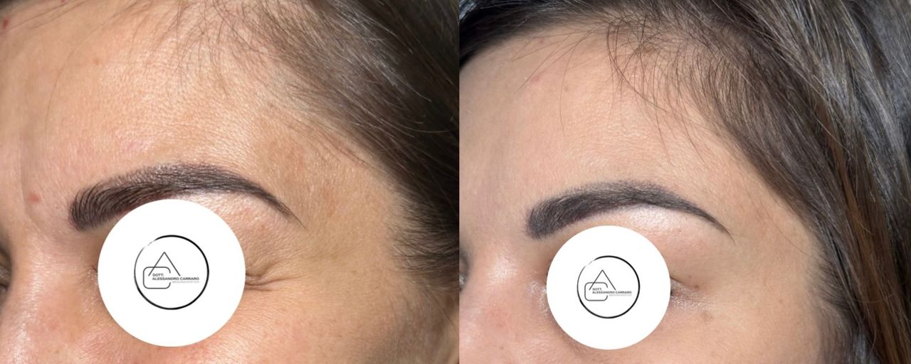 Alessandro Carraro-9