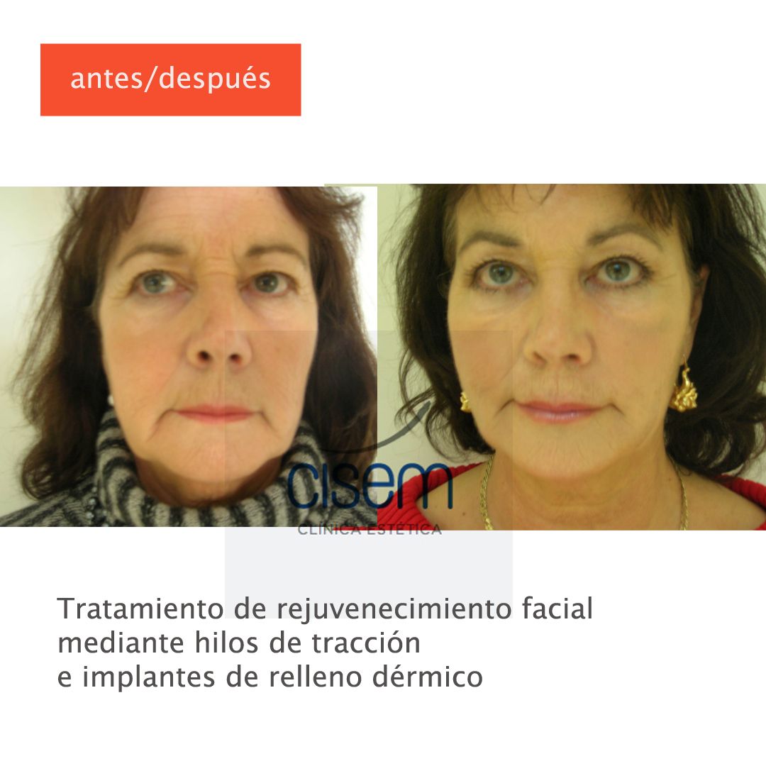 Manuel Prieto Pérez-28