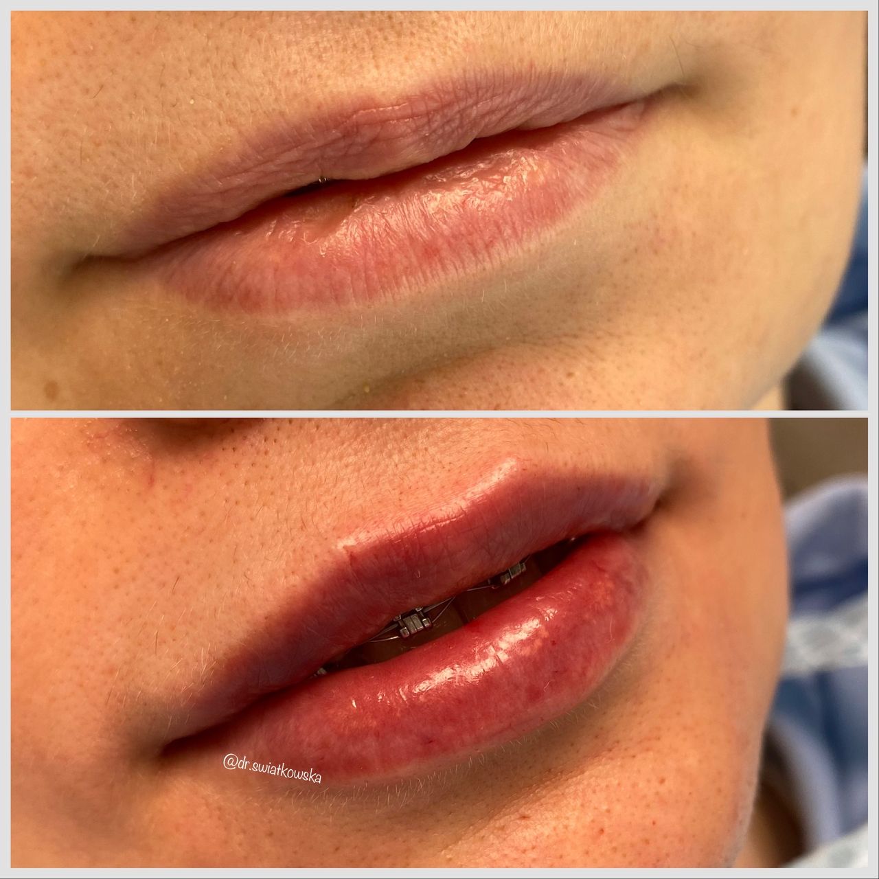 Angelika Świątkowska-38