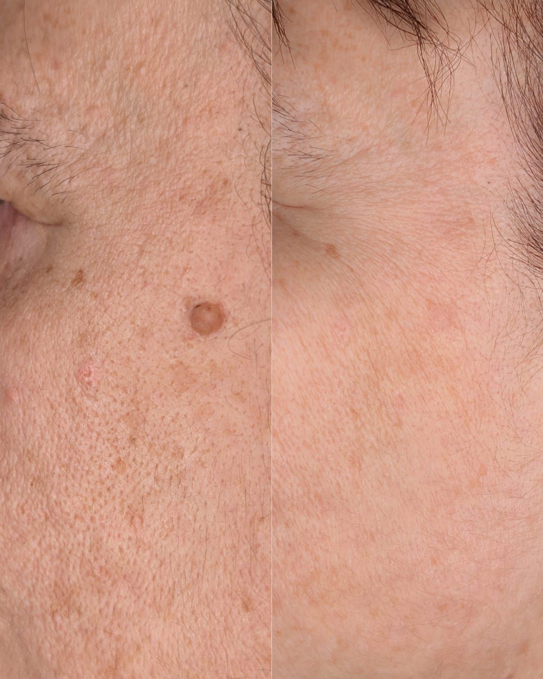 Francesco Maria Pepe-1