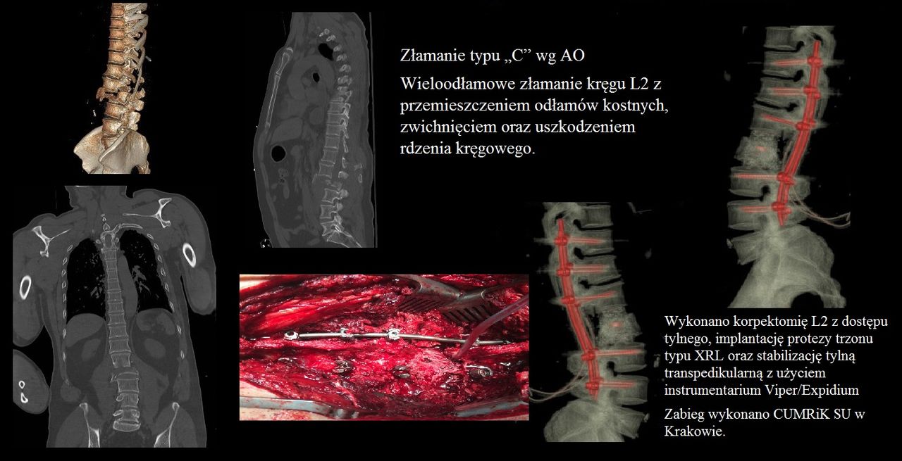 Daniel Płomiński-18