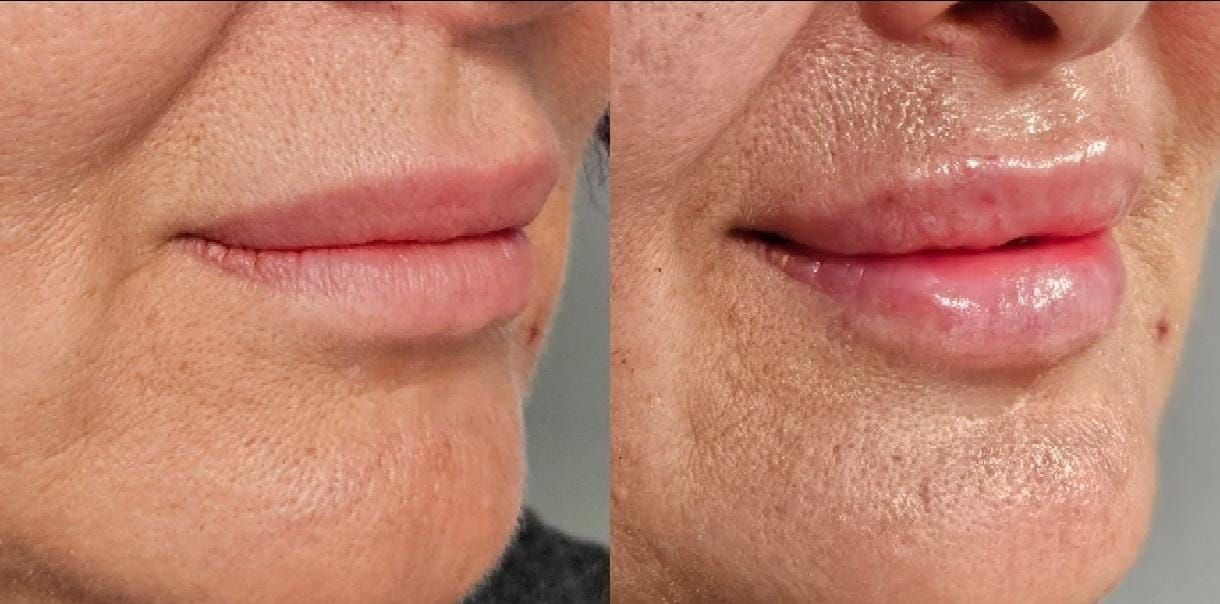 Rosalba Herrero Zerpa-574