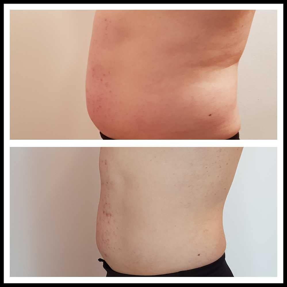 Rosalba Herrero Zerpa-368