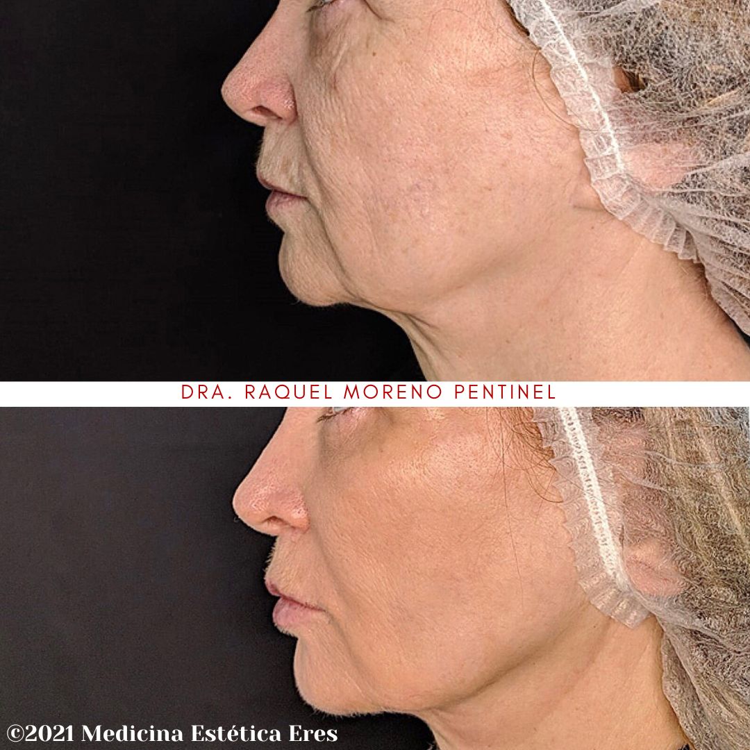 Raquel Moreno Pentinel-96