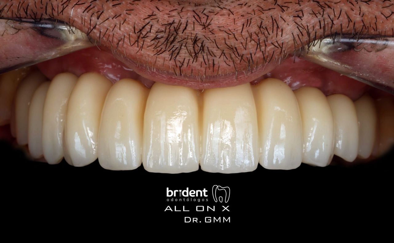 Guillermo Moreno Masiá-71