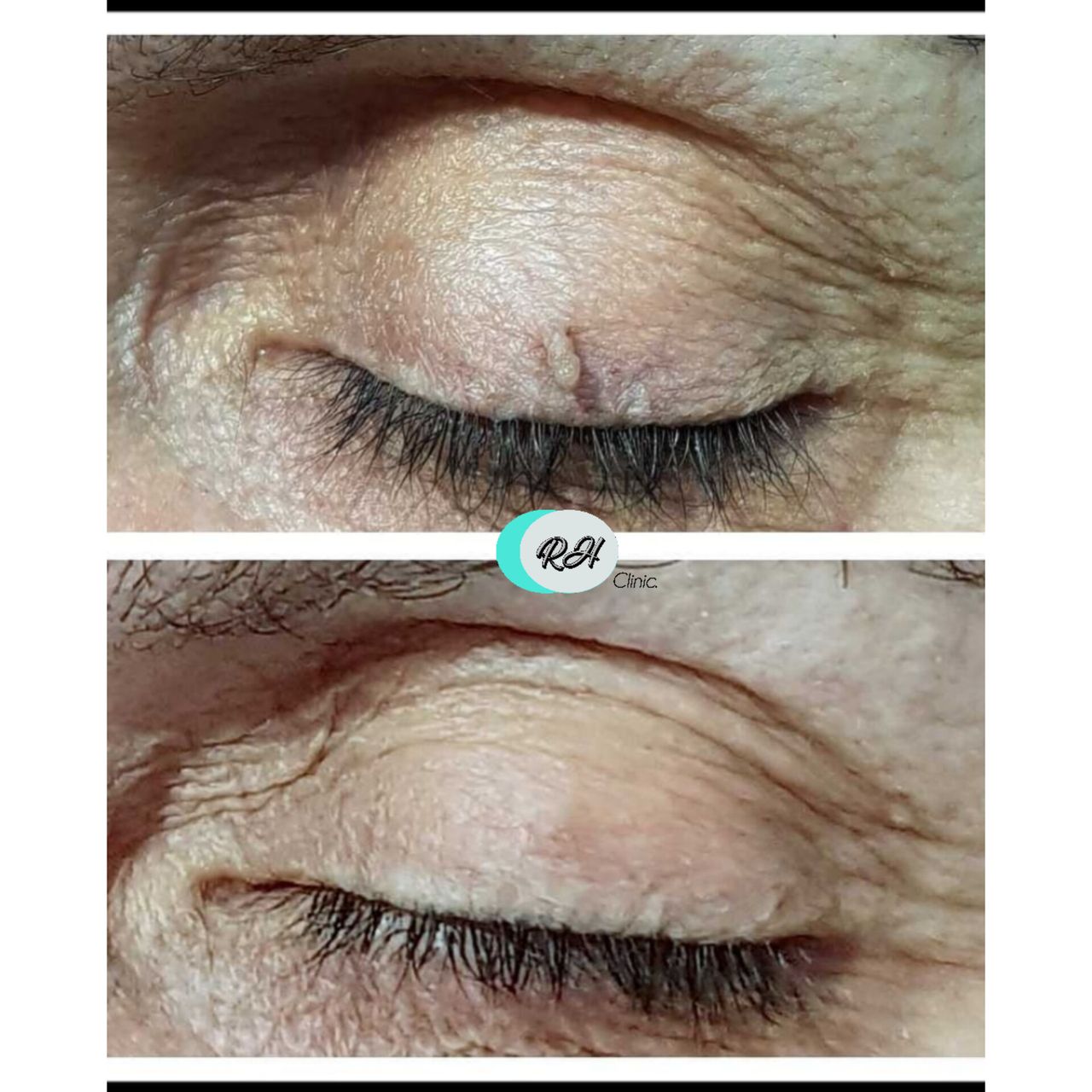 Rosalba Herrero Zerpa-97