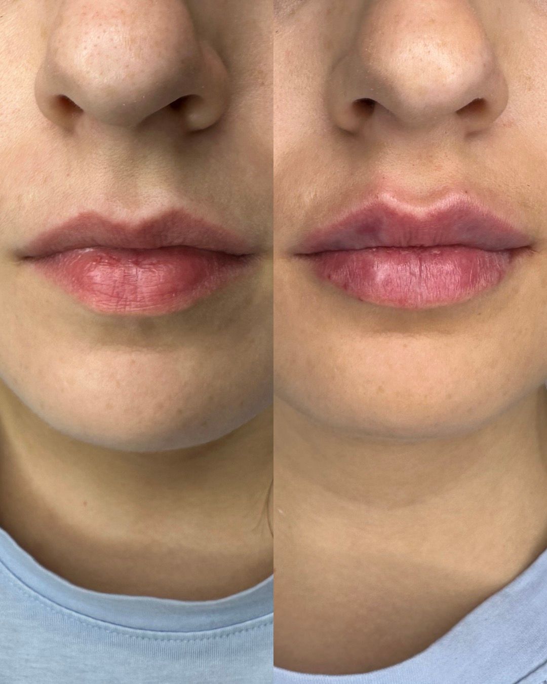 Michalina Zagańczyk-Bączek-38