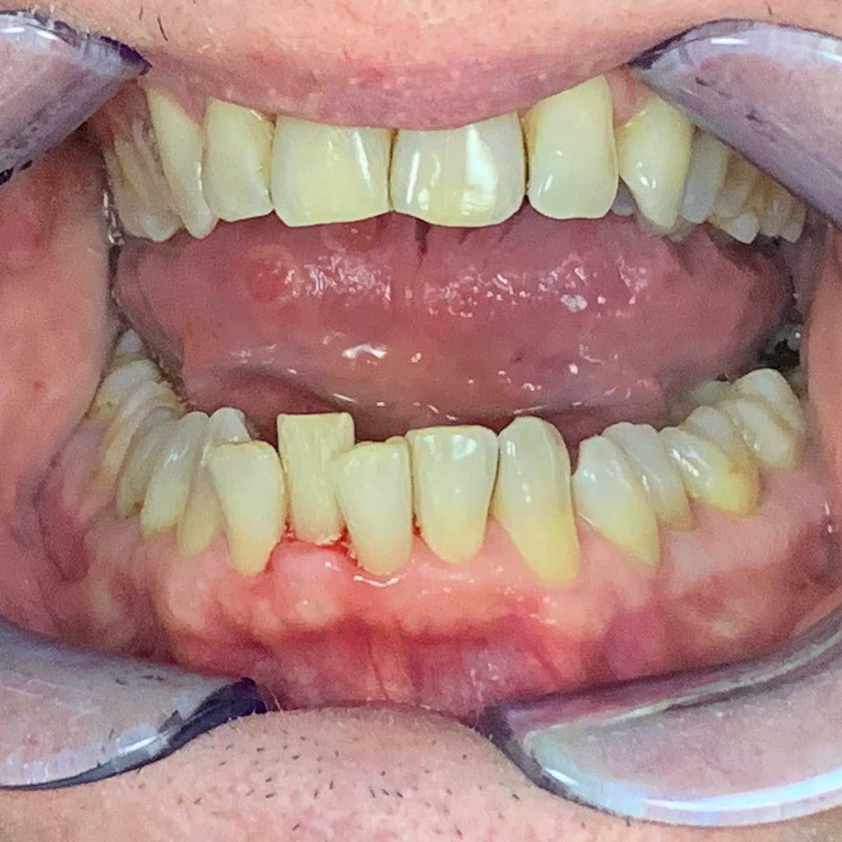 Gianluigi Bittante-83